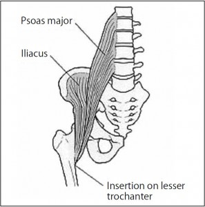 Fig. 3. Iliopsoas