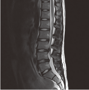 図1．MRI診断画像