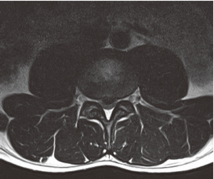図2．MRI診断画像