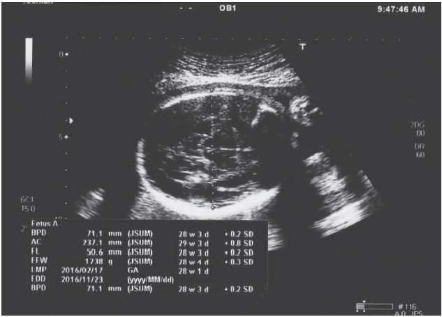 図1．2016年９月１日　超音波診断画像